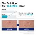 Mediheal Madecassoside Blemish Repair Serum