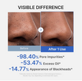 Before-and-after comparison of a nose showing reduced pore impurities, excess oil, and blackheads, with text reading 'VISIBLE DIFFERENCE' and percentages after 1 use. Medicube Zero Pore Blackhead Mud Mask 100g