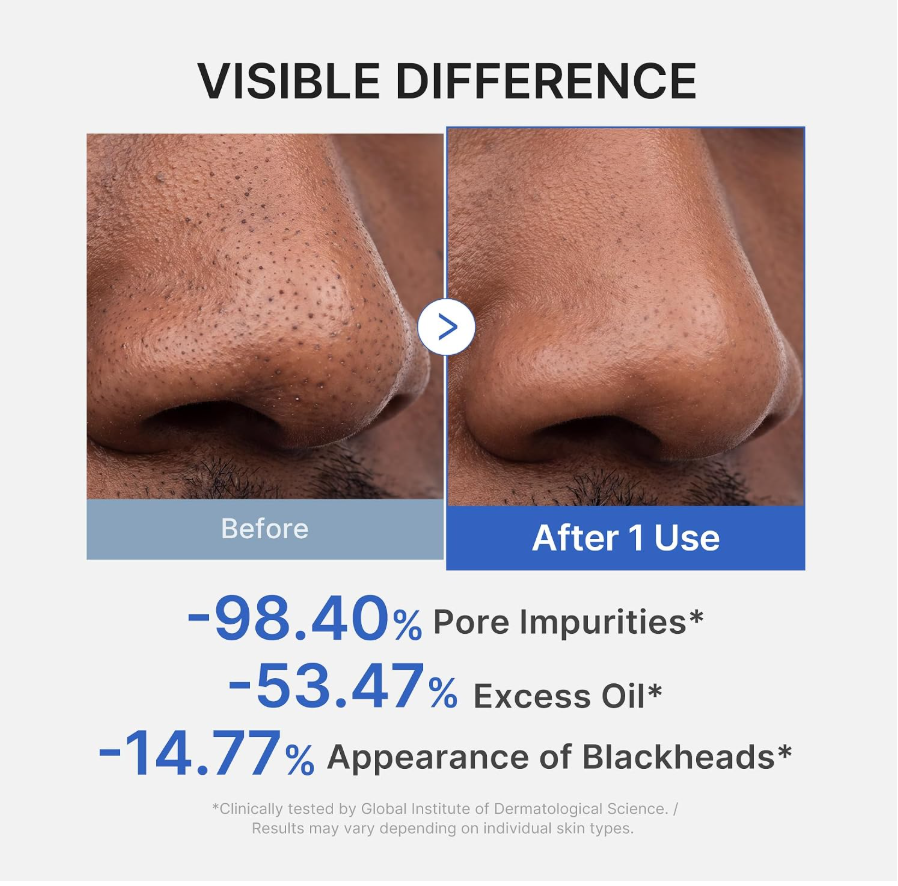 Before-and-after comparison of a nose showing reduced pore impurities, excess oil, and blackheads, with text reading 'VISIBLE DIFFERENCE' and percentages after 1 use. Medicube Zero Pore Blackhead Mud Mask 100g