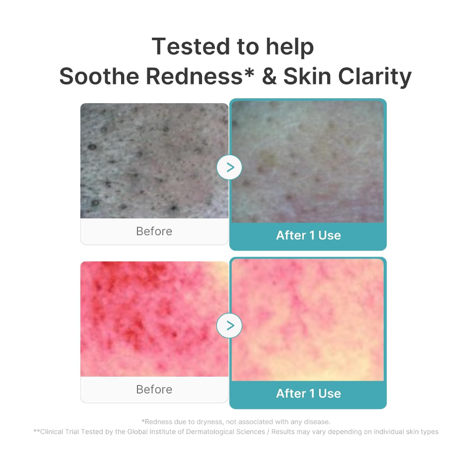 A tube of Medicube Azelaic Acid Capsule Cleansing Foam in a light aqua color, shown with a dollop of the foaming cleanser and a large bubble behind it on a white background. Medicube Azelaic Acid Capsule Cleansing Foam 120g