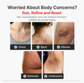 Promotional graphic for a skincare product with the headline 'Worried About Body Concerns?' and the text 'Rub, Refine and Reset.' Below, five inset photos show close-ups of body areas with skin issues: chest, back, elbows, buttocks, and underarms, each labeled with a check mark. Medicube Kojic Acid Turmeric Body Peel Shot 280ml