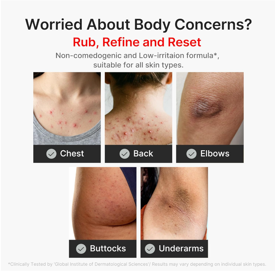 Promotional graphic for a skincare product with the headline 'Worried About Body Concerns?' and the text 'Rub, Refine and Reset.' Below, five inset photos show close-ups of body areas with skin issues: chest, back, elbows, buttocks, and underarms, each labeled with a check mark. Medicube Kojic Acid Turmeric Body Peel Shot 280ml