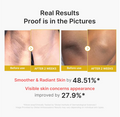 Before and after results of a skin treatment showing smoother and radiant skin. Medicube Kojic Acid Turmeric Body Peel Shot 280ml