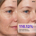 Before-and-after comparison of a woman's eye area showing reduction in wrinkles, with dashed white outlines highlighting the treated region and text stating '116.12% Improvement in eye area wrinkles'. Sungboon Editor Silk Peptide EGF Intensive Gold Mask 4ea
