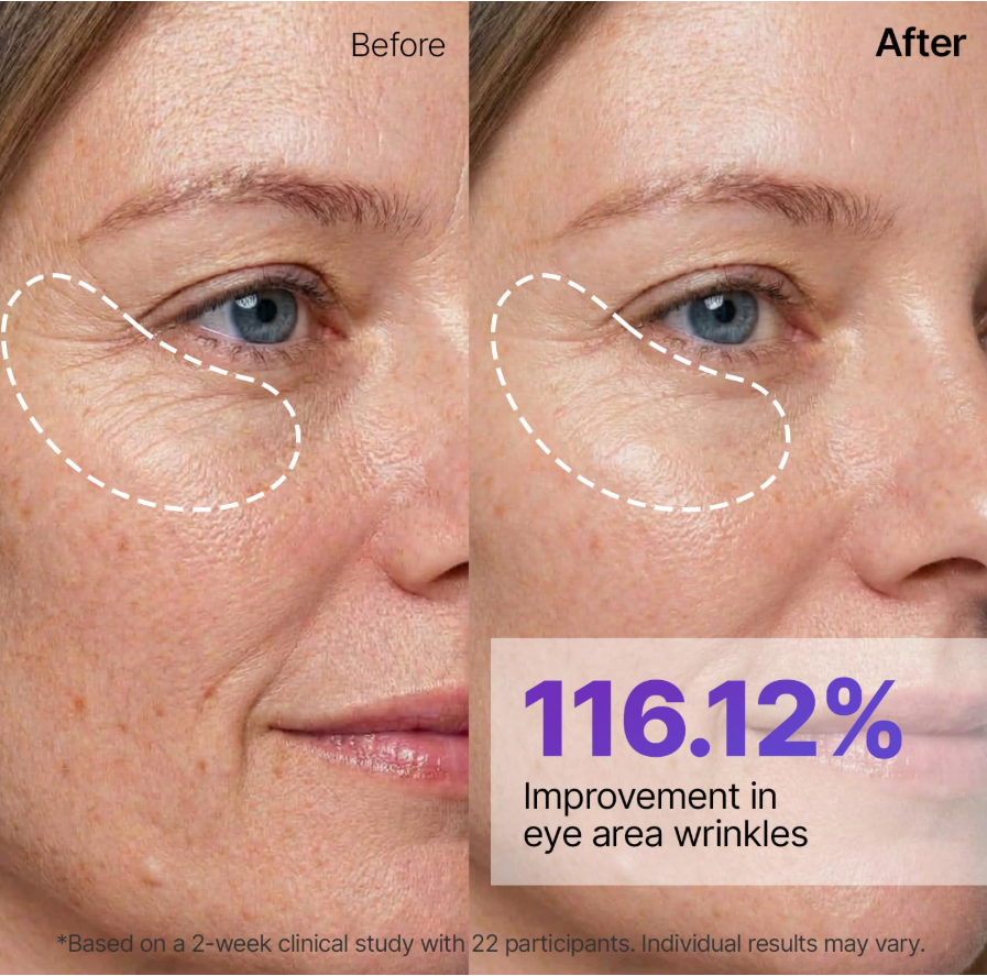 Before-and-after comparison of a woman's eye area showing reduction in wrinkles, with dashed white outlines highlighting the treated region and text stating '116.12% Improvement in eye area wrinkles'. Sungboon Editor Silk Peptide EGF Intensive Gold Mask 4ea