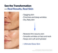 A skincare transformation graphic showing before-and-after close-up photos of a person's lower face and cheek, with text describing skin improvements such as sagging skin, fine lines, wrinkles, and dry flaky skin. The bottom panel shows smoother, more hydrated skin, and the graphic concludes with '= Ultimate Glass Skin'. Sungboon Editor Deep Collagen Retinol Power Boosting Capsule Cream 50ml
