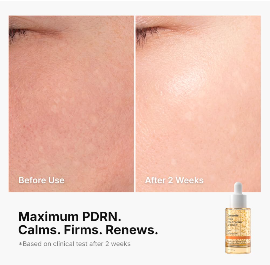 Before-and-after skincare comparison showing close-up facial skin texture, with the left panel labeled 'Before Use' and the right panel labeled 'After 2 Weeks.' Text below reads 'Maximum PDRN. Genabelle PDRN Vita Toning Ampoule 30ml