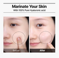 Before-and-after comparison showing a close-up of a woman's cheek with a dotted circle highlighting skin texture, under the headline 'Marinate Your Skin With 100% Pure Hyaluronic acid'. Wellage Real Hyaluronic Blue Ampoule 100 60ml