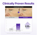 A marketing infographic titled 'Clinically Proven Results' showing before-and-after skin elasticity results on a woman's face, with a bar chart indicating 1% improvement before use and 5.18% improvement after 4 weeks. Centellian24 360° Shot PDRN Active Serum 50ml