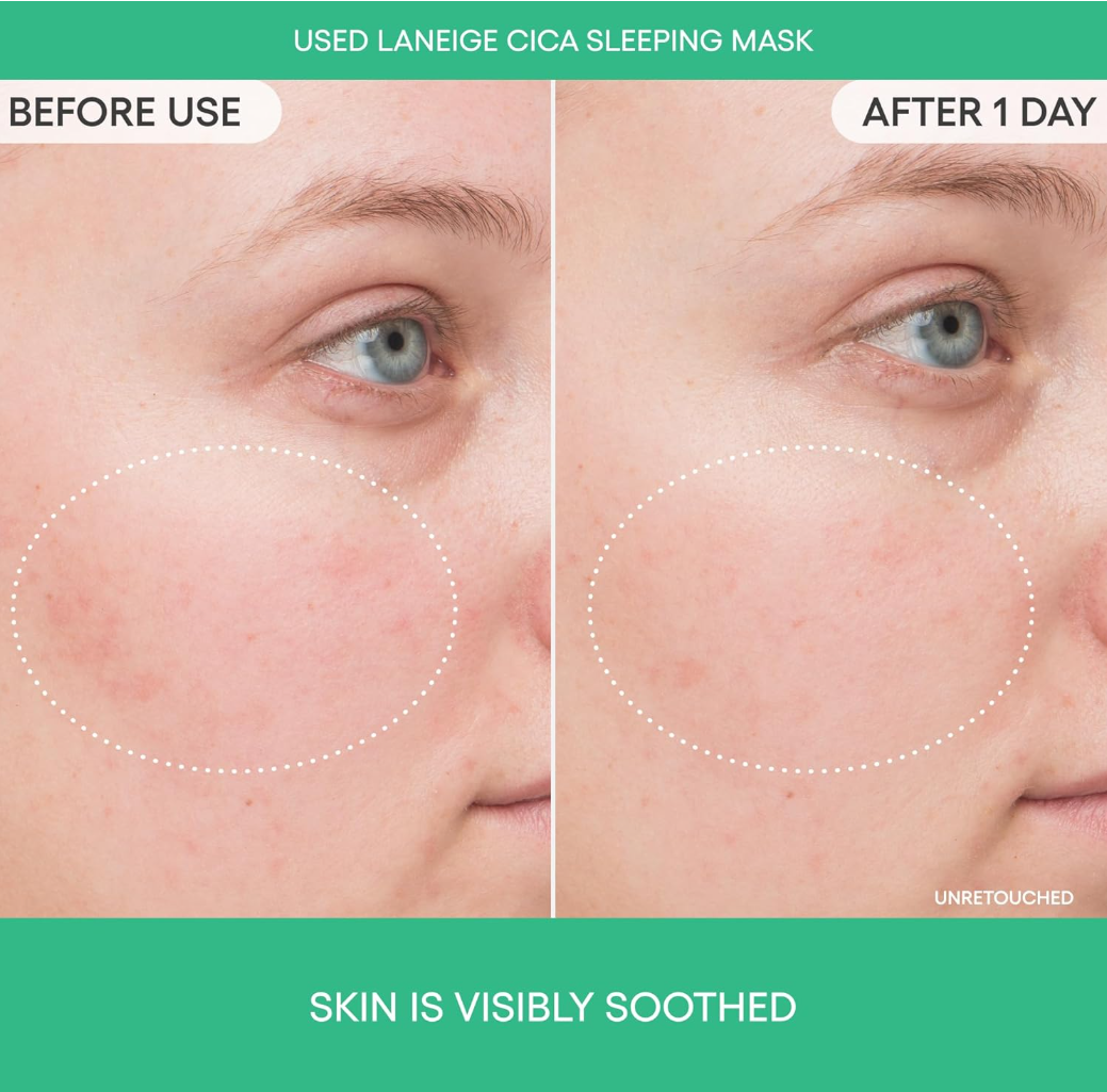 Before and after使用Laneige Cica睡眠面膜的皮肤对比图, LANEIGE Cica Sleeping Mask 60ml