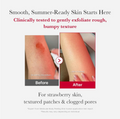 Before and after comparison of skin texture with text about clinical testing and product benefits, Medicube Red Acne Body Peeling Shot 110g