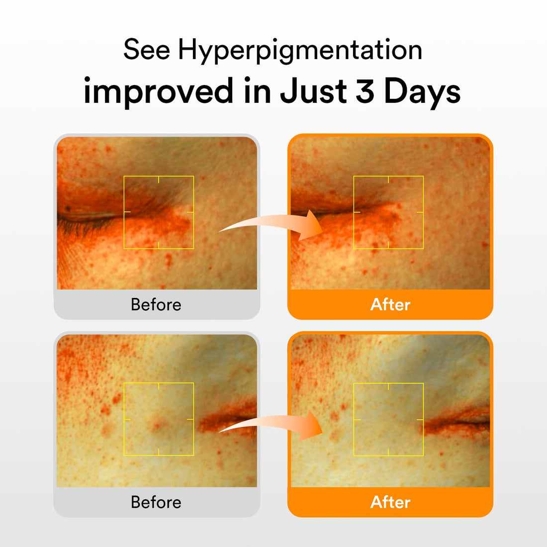 Abib Glutathiosome Dark Spot Serum 50ml