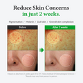 Before and after comparison of skin concerns with text indicating results in 2 weeks, Dr.althea Gentle Vitamin C Serum 30ml