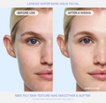 Before and after comparison of a Laneige Water Bank Aqua Facial on a person's face, Laneige Water Bank Aqua Facial Serum 30ml