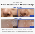 Before and after comparison of skin texture and complexion with text highlighting benefits, Medicube One Day Exosome Shot Pore Ampoule 2000 30ml