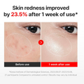 Before and after comparison of skin redness improvement with text indicating 23.5% reduction after one week of use, Centellan24 The Madeca Cream 50ml