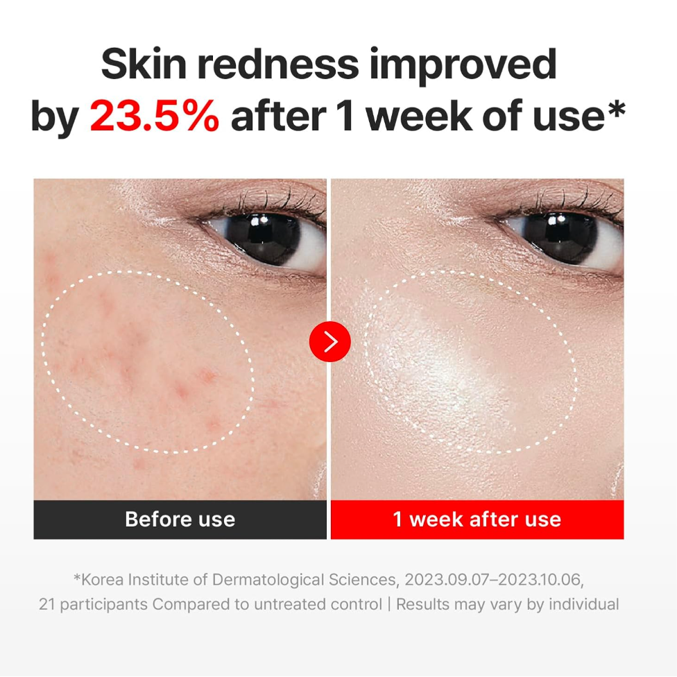 Before and after comparison of skin redness improvement with text indicating 23.5% reduction after one week of use, Centellan24 The Madeca Cream 50ml