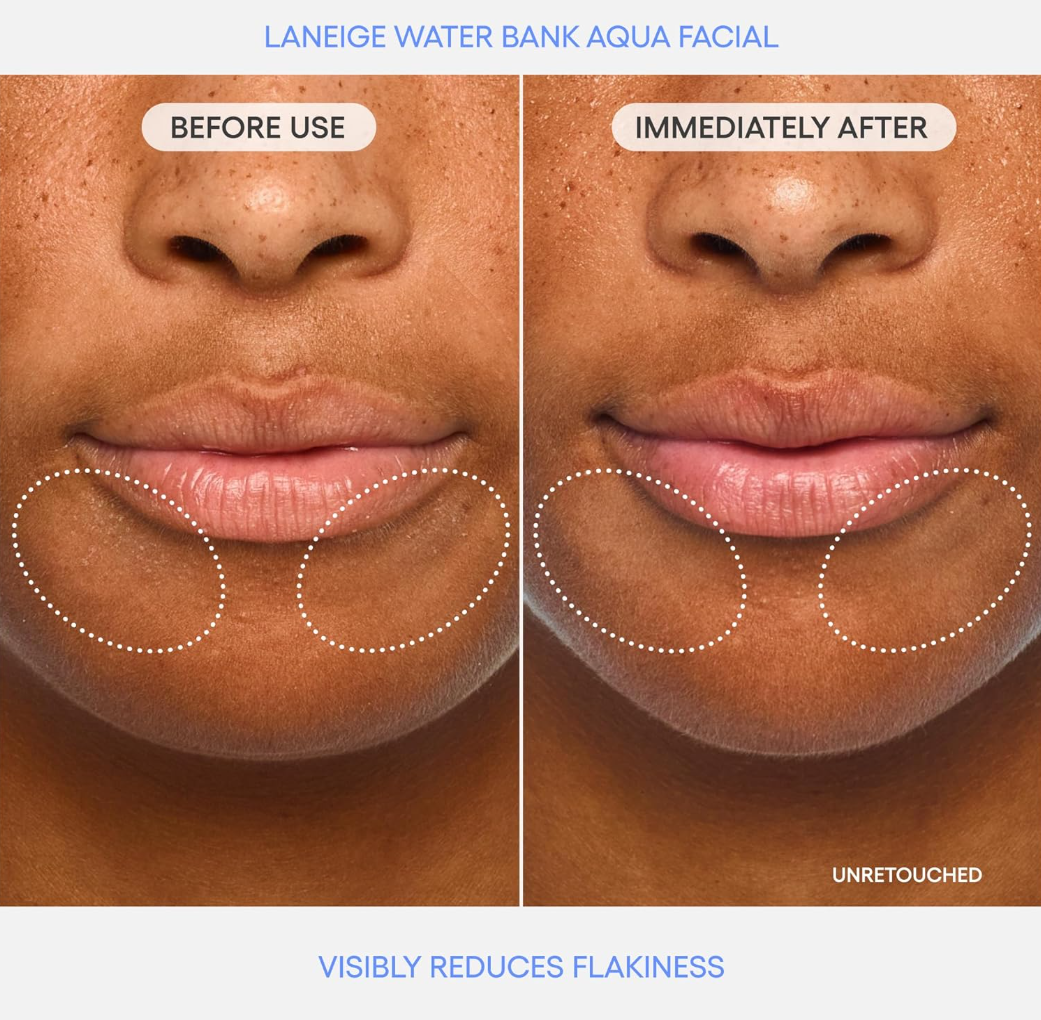 Before and after comparison of Laneige Water Bank Aqua Facial on a person's face, showing reduced flakiness, Laneige Water Bank Aqua Facial Serum 30ml