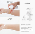 Before and after comparison of skin treatment with Dr. Althea product, showing redness being treated, Dr.Althea Amino Acid Gentle Bubble Cleanser 140ml