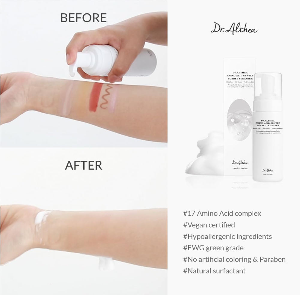 Before and after comparison of skin treatment with Dr. Althea product, showing redness being treated, Dr.Althea Amino Acid Gentle Bubble Cleanser 140ml
