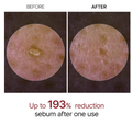 Before and after comparison of sebum reduction on skin with text indicating 193% reduction, Dr.Melaxin PEEL SHOT EXFOLIATING WHITE RICE AMPOULE 80ml