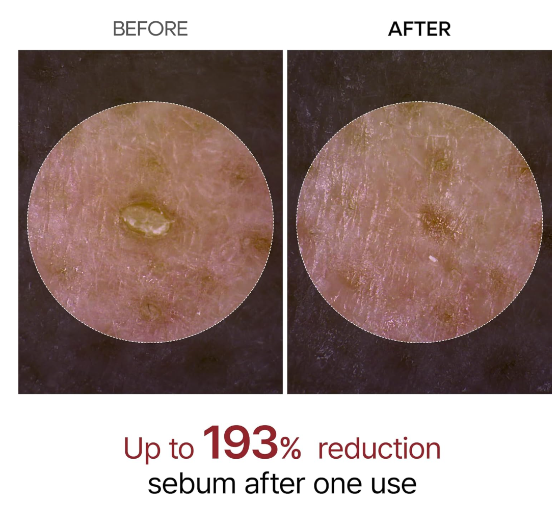 Before and after comparison of sebum reduction on skin with text indicating 193% reduction, Dr.Melaxin PEEL SHOT EXFOLIATING WHITE RICE AMPOULE 80ml