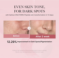 Before and after skin transformation with dark spot reduction on a pink background, Medicube PDRN Pink Cica Soothing Toner 250ml