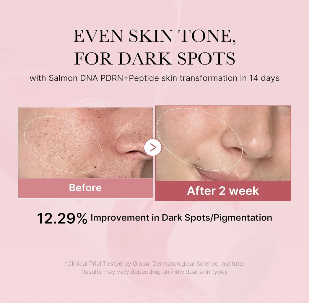 Before and after skin transformation with dark spot reduction on a pink background, Medicube PDRN Pink Cica Soothing Toner 250ml