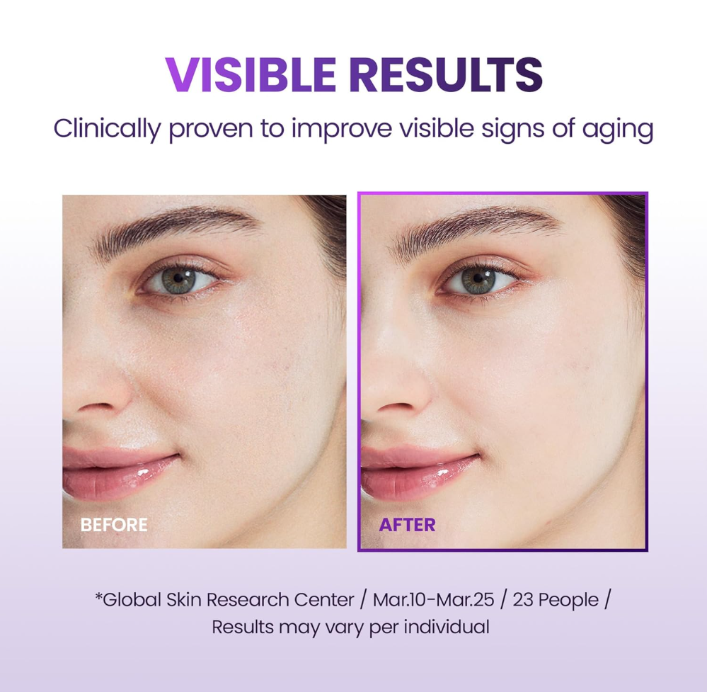Before and after comparison of facial skin with visible aging improvement, on a purple background, BOH Probioderm 3D Lifting Cream Mask
