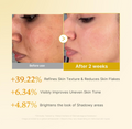 Before and after skin treatment comparison with text on a beige background, Medicube Kojic Acid Turmeric Resurfacing Toner 250ml