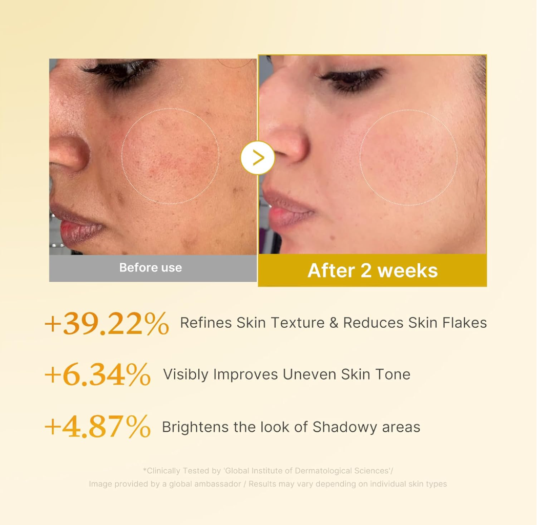 Before and after skin treatment comparison with text on a beige background, Medicube Kojic Acid Turmeric Resurfacing Toner 250ml