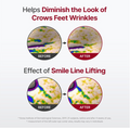 Before and after effect of a skincare product on crow's feet wrinkles with text and graphics, Centellian24 Madeca Derma Mask lll Intensive Formula 10ea