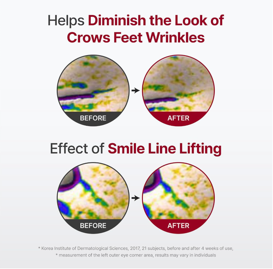 Before and after effect of a skincare product on crow's feet wrinkles with text and graphics, Centellian24 Madeca Derma Mask lll Intensive Formula 10ea