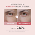 Before and after comparison of eye area firmness improvement with text indicating a 2.87% increase, Medicube PDRN Pink Peptide Eye Cream 30ml