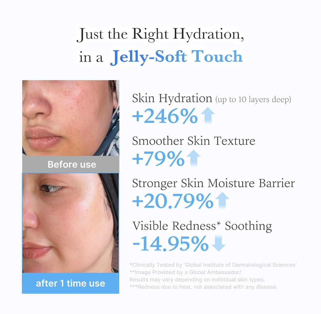 Advertisement showing before and after effects of a skincare product on skin hydration and texture, Medicube Hyaluronic Ceramide Jelly Cream 50ml