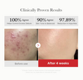 Medicube Red Succinic Acid Peeling Pad 155g, results