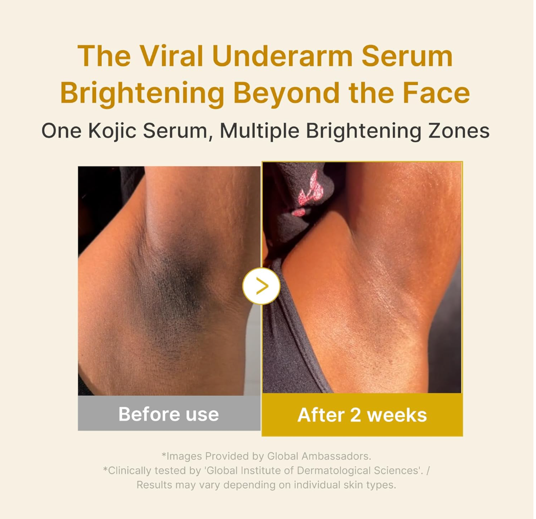 Before and after comparison of underarm skin with a Kojic Serum, showing brightening effect, Medicube Kojic Acid Turmeric Niacinamide Serum 30ml