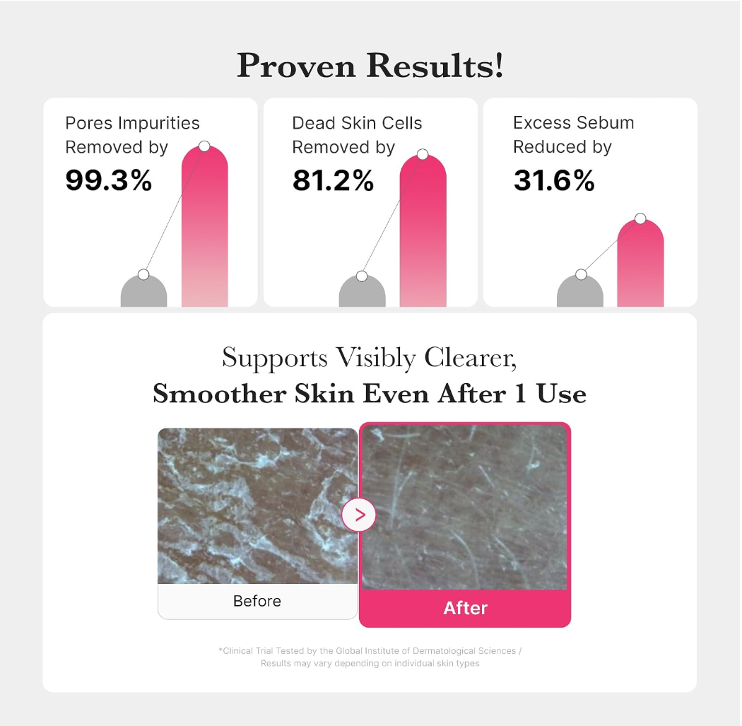 Bar graph showing skin improvement percentages with before and after images of skin texture, Medicube PDRN Hydrating Gel Cleanser 200ml