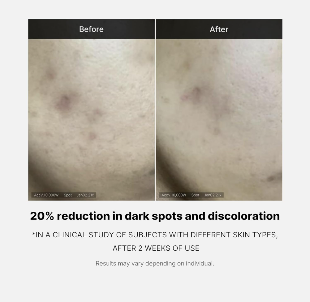 Before and after comparison of skin with dark spots, showing a 20% reduction, Medicube Deep Vita C Ampoule 2.0 30g