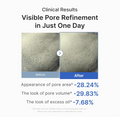 Before and after comparison of visible pore refinement with clinical results on a white background, Medicube Zero Pore One Day Peptide Serum 30ml