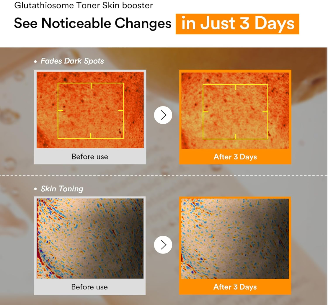 Before and after effects of a Glutathione Toner on skin texture and dark spots, Abib Glutathiosome Dark Spot Toner 200ml