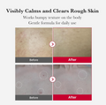 Before and after comparison of skin texture with text indicating product benefits, Medicube Red Acne Body Peeling Shot 110g
