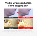 Before and after effects of a skincare product on skin texture and wrinkles, Centellan24 The Madeca Cream 50ml