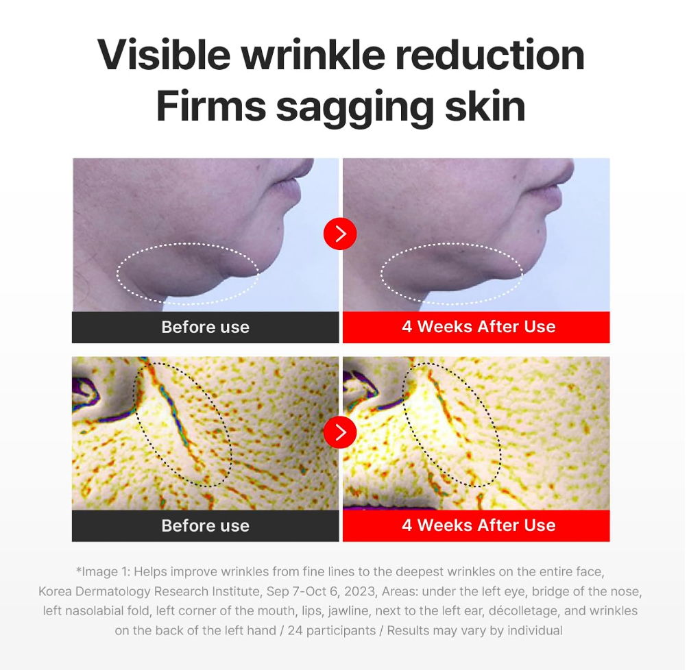 Before and after effects of a skincare product on skin texture and wrinkles, Centellan24 The Madeca Cream 50ml