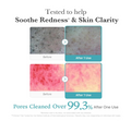Before and after effects of a skincare product on skin redness and clarity with text indicating pore cleaning results, Medicube Azelacia Acid Niacinamide Deep Clean Foam Cleanser 120g