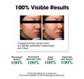 Before and after comparison of skin with text about 100% visible results on a white background, Somebymi AHA.BHA.PHA 30 Days Miracle Toner 150ml
