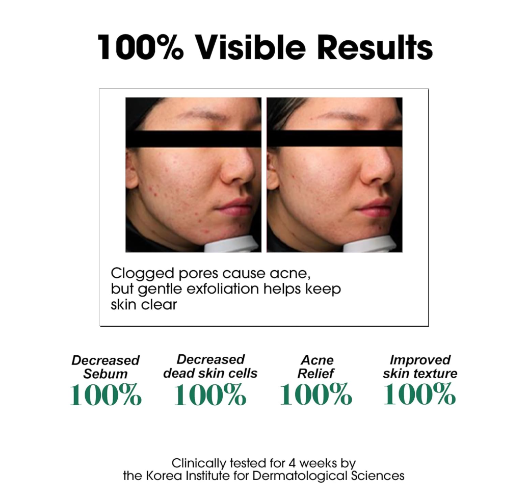 Before and after comparison of skin with text about 100% visible results on a white background, Somebymi AHA.BHA.PHA 30 Days Miracle Toner 150ml