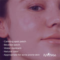 Close-up of a person's face with ISNTREE product application, featuring text about product features, ISNTREE Onion Newpair Spot Pach basic-24 patches