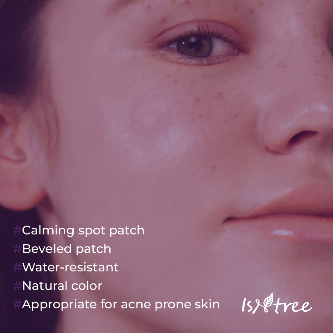 Close-up of a person's face with ISNTREE product application, featuring text about product features, ISNTREE Onion Newpair Spot Pach basic-24 patches