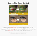 Before and after effect of eye treatment on bags under eyes with text about results, MEDICUBE Kojic Acid Turmeric Vita Eye Gel Serum 30ml